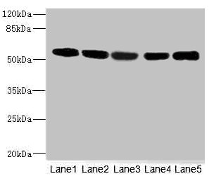 FRK Antibody - Western blot All Lanes: FRKantibody at 3.13ug/ml Lane 1 : Hela whole cell lysate Lane 2 : 293T whole cell lysate Lane 3 : K562 whole cell lysate Lane 4 : MCF7 whole cell lysate Lane 5 : HepG-2 whole cell lysate Secondary Goat polyclonal to Rabbit IgG at 1/10000 dilution Predicted band size: 59,42 kDa Observed band size: 58 kDa