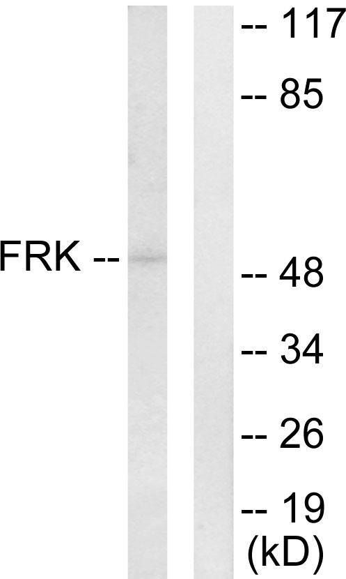 FRK Antibody - Western blot analysis of extracts from Jurkat cells, using FRK antibody.