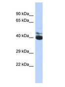 FRMD3 Antibody - FRMD3 antibody Western Blot of HepG2. Antibody dilution: 1 ug/ml.  This image was taken for the unconjugated form of this product. Other forms have not been tested.