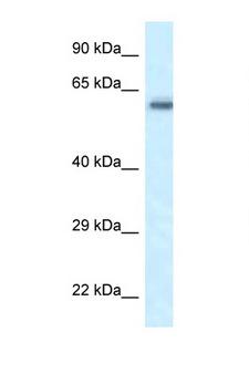 FRMD5 Antibody - FRMD5 antibody Western blot of Rat Muscle lysate. Antibody concentration 1 ug/ml.  This image was taken for the unconjugated form of this product. Other forms have not been tested.