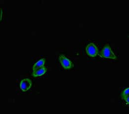 FRMD5 Antibody - Immunofluorescent analysis of HepG-2 cells diluted at 1:100 and Alexa Fluor 488-congugated AffiniPure Goat Anti-Rabbit IgG(H+L)