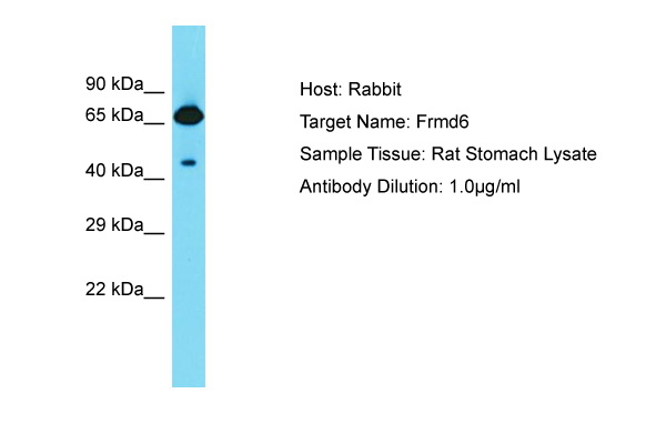 FRMD6 Antibody -  This image was taken for the unconjugated form of this product. Other forms have not been tested.