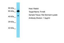 FRMD6 Antibody -  This image was taken for the unconjugated form of this product. Other forms have not been tested.