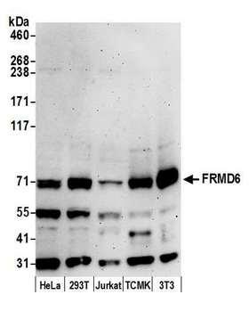 FRMD6 Antibody - Detection of human and mouse FRMD6 by western blot. Samples: Whole cell lysate (15 µg) from HeLa, HEK293T, Jurkat, mouse TCMK-1, and mouse NIH 3T3 cells prepared using NETN lysis buffer. Antibody: Affinity purified rabbit anti-FRMD6 antibody used for WB at 1:1000. Detection: Chemiluminescence with an exposure time of 3 minutes.