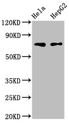 FRMD6 Antibody - Western Blot Positive WB detected in: Hela whole cell lysate, HepG2 whole cell lysate All lanes: FRMD6 antibody at 3µg/ml Secondary Goat polyclonal to rabbit IgG at 1/50000 dilution Predicted band size: 73, 71, 30 kDa Observed band size: 73 kDa