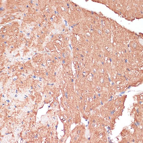 FRMD6 Antibody - Immunohistochemistry of paraffin-embedded Mouse heart using FRMD6 Polyclonal Antibody at dilution of 1:100 (40x lens).