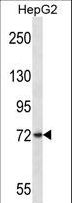 FRMD7 Antibody - FRMD7 Antibody western blot of HepG2 cell line lysates (35 ug/lane). The FRMD7 antibody detected the FRMD7 protein (arrow).