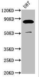 FRMD7 Antibody - Western Blot Positive WB detected in: U87 whole cell lysate All Lanes: FRMD7 antibody at 3.7µg/ml Secondary Goat polyclonal to rabbit IgG at 1/50000 dilution Predicted band size: 82, 80 KDa Observed band size: 82 KDa