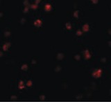 FRMPD1 Antibody - Immunofluorescence of FRMPD1 in K562 cells with FRMPD1 antibody at 20 ug/ml.