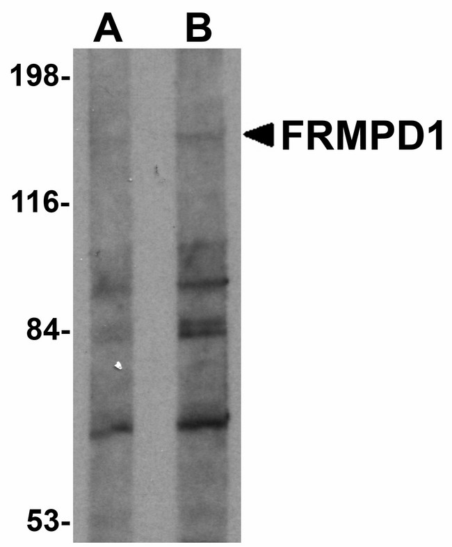 FRMPD1 Antibody - Western blot of FRMPD1 in K562 cell lysate with FRMPD1 antibody at (A) 1 and (B) 2 ug/ml. Below: Immunofluorescence of FRMPD1 in K562 cells with FRMPD1 antibody at 20 ug/ml.