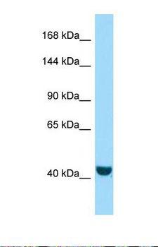 FRMPD2 Antibody - Western blot of Human A549. FRMPD2 antibody dilution 1.0 ug/ml.  This image was taken for the unconjugated form of this product. Other forms have not been tested.