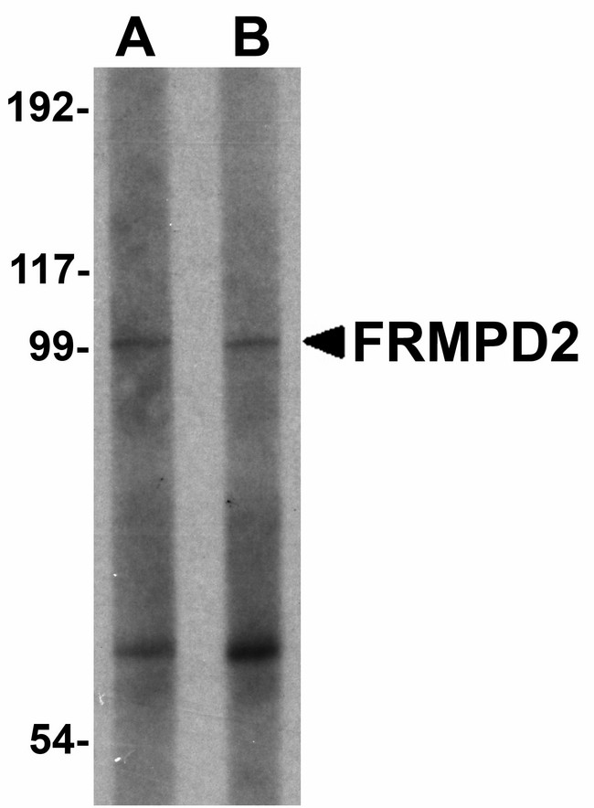FRMPD2 Antibody - Western blot of FRMPD2 in rat kidney tissue lysate with FRMPD2 antibody at (A) 1 and (B) 2 ug/ml. Below: Immunohistochemistry of FRMPD2 in mouse kidney tissue with FRMPD2 antibody at 5 ug/ml.