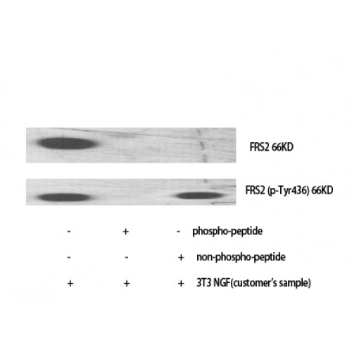 FRS2 Antibody - Western blot of FRS2 antibody
