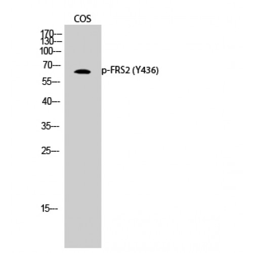 FRS2 Antibody - Western blot of Phospho-FRS2 (Y436) antibody