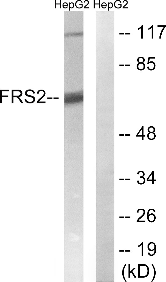 FRS2 Antibody - Western blot analysis of lysates from HepG2 cells, using FRS2 Antibody. The lane on the right is blocked with the synthesized peptide.