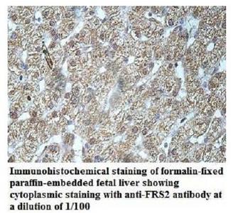 FRS2 Antibody - Immunohistochemistry of FRS2 antibody