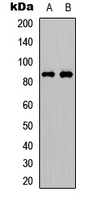 FRS2 Antibody - Western blot analysis of FRS2 (pY436) expression in Jurkat (A); Huvec (B) whole cell lysates.