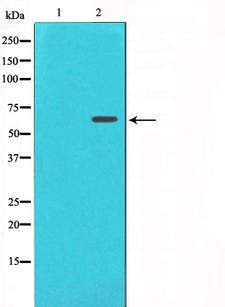 FRS2 Antibody - Western blot analysis on COS7 cell lysates using FRS2 antibody. The lane on the left is treated with the antigen-specific peptide.