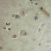 FRS2 Antibody - Phospho-FRS2 (Tyr436) antibody for IHC in human brain tissue 