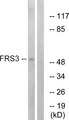 FRS3 Antibody - Western blot analysis of lysates from COS7 cells, using FRS3 Antibody. The lane on the right is blocked with the synthesized peptide.
