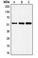 FRS3 Antibody - Western blot analysis of FRS3 expression in MCF7 (A); mouse brain (B); rat brain (C) whole cell lysates.