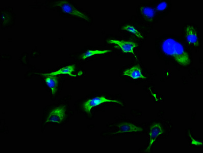 FRS3 Antibody - Immunofluorescence staining of U251 cells with FRS3 Antibody at 1:466, counter-stained with DAPI. The cells were fixed in 4% formaldehyde, permeabilized using 0.2% Triton X-100 and blocked in 10% normal Goat Serum. The cells were then incubated with the antibody overnight at 4°C. The secondary antibody was Alexa Fluor 488-congugated AffiniPure Goat Anti-Rabbit IgG(H+L).
