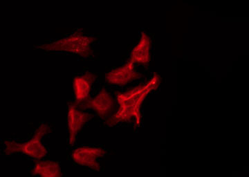 FRS3 Antibody - Staining HeLa cells by IF/ICC. The samples were fixed with PFA and permeabilized in 0.1% Triton X-100, then blocked in 10% serum for 45 min at 25°C. The primary antibody was diluted at 1:200 and incubated with the sample for 1 hour at 37°C. An Alexa Fluor 594 conjugated goat anti-rabbit IgG (H+L) Ab, diluted at 1/600, was used as the secondary antibody.