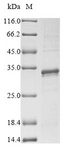 RPL10 / Ribosomal Protein L10 Protein - (Tris-Glycine gel) Discontinuous SDS-PAGE (reduced) with 5% enrichment gel and 15% separation gel.