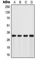 FSBP Antibody - Western blot analysis of FSBP expression in Jurkat (A); HeLa (B); NIH3T3 (C); mouse stomach (D) whole cell lysates.