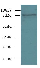 FSCB Antibody - Western blot. All lanes: FSCB antibody at 1.5 ug/ml+ Mouse liver tissue Goat polyclonal to rabbit at 1:10000 dilution. Predicted band size: 88 kDa. Observed band size: 88 kDa.