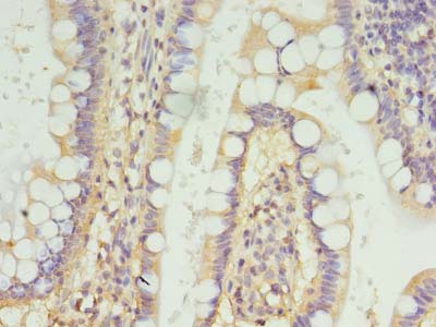 FSCB Antibody - Immunohistochemistry of paraffin-embedded human small intestine tissue using antibody at dilution of 1:100.