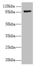 FSCB Antibody - Western blot All lanes: FSCB antibody at 1.5µg/ml + Mouse liver tissue Secondary Goat polyclonal to rabbit IgG at 1/10000 dilution Predicted band size: 88 kDa Observed band size: 88 kDa