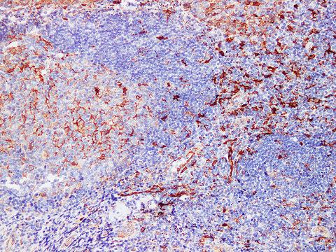 FSCN / Fascin Antibody