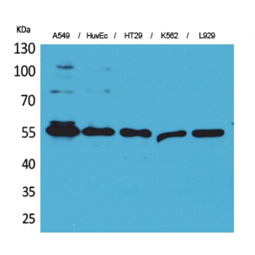 FSCN1 / Fascin Antibody - Western blot of Fascin 1 antibody