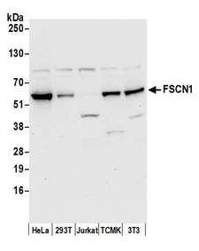 FSCN1 / Fascin Antibody - Detection of human and mouse FSCN1 by western blot. Samples: Whole cell lysate (50 µg) from HeLa, 293T, Jurkat, mouse TCMK-1, and mouse NIH3T3 cells prepared using NETN lysis buffer. Antibody: Affinity purified rabbit anti-FSCN1 antibody used for WB at 0.4 µg/ml. Detection: Chemiluminescence with an exposure time of 10 seconds.