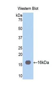 FSCN1 / Fascin Antibody - Western blot of recombinant FSCN1 / Fascin.  This image was taken for the unconjugated form of this product. Other forms have not been tested.