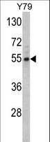 FSCN1 / Fascin Antibody - Western blot of Fascin Antibody in Y79 cell line lysates (35 ug/lane). Fascin (arrow) was detected using the purified antibody.