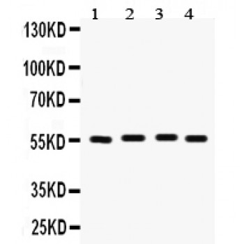 FSCN1 / Fascin Antibody - Fascin antibody Western blot. All lanes: Anti Fascin at 0.5 ug/ml. Lane 1: Rat Brain Tissue Lysate at 50 ug. Lane 2: Rat Lung Tissue Lysate at 50 ug. Lane 3: HELA Whole Cell Lysate at 40 ug. Lane 4: SKOV Whole Cell Lysate at 40 ug. Predicted band size: 55 kD. Observed band size: 55 kD.