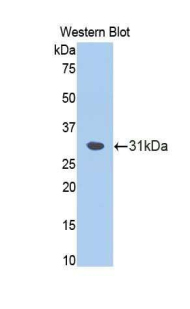 FSCN1 / Fascin Antibody - Western blot of recombinant FSCN1 / Fascin.  This image was taken for the unconjugated form of this product. Other forms have not been tested.