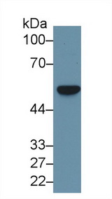 FSCN1 / Fascin Antibody - Western Blot; Sample: Human Hela cell lysate; Primary Ab: 1µg/ml Rabbit Anti-Rat FSCN Antibody Second Ab: 0.2µg/mL HRP-Linked Caprine Anti-Rabbit IgG Polyclonal Antibody