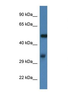 FSCN1 / Fascin Antibody - FSCN1 / Fascin antibody Western blot of Mouse Thymus lysate. Antibody concentration 1 ug/ml. This image was taken for the unconjugated form of this product. Other forms have not been tested.