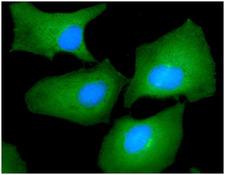 FSCN1 / Fascin Antibody - ICC/IF analysis of FSCN1 in HeLa cells line, stained with DAPI (Blue) for nucleus staining and monoclonal anti-human FSCN1 antibody (1:100) with goat anti-mouse IgG-Alexa fluor 488 conjugate (Green).