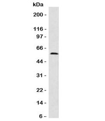 FSCN1 / Fascin Antibody - Western blot testing of Fascin antibody (clone FAN55-1) and HeLa cell lysate.  This image was taken for the unmodified form of this product. Other forms have not been tested.