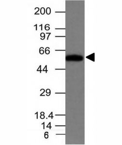 FSCN1 / Fascin Antibody - Western blot of HeLa cell lysate using Fascin antibody (FSN1/417).  This image was taken for the unmodified form of this product. Other forms have not been tested.