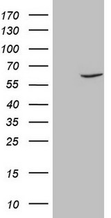 FSCN1 / Fascin Antibody - HEK293T cells were transfected with the pCMV6-ENTRY control. (Left lane) or pCMV6-ENTRY FSCN1. (Right lane) cDNA for 48 hrs and lysed. Equivalent amounts of cell lysates. (5 ug per lane) were separated by SDS-PAGE and immunoblotted with anti-FSCN1. (1:500)
