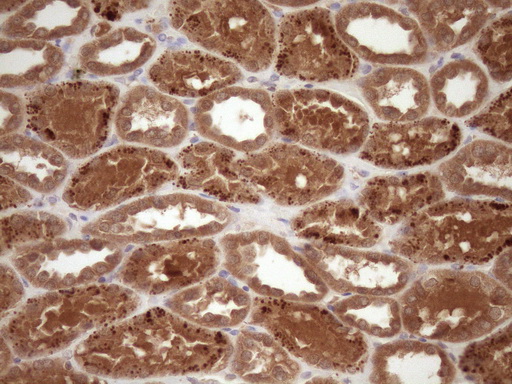 FSCN1 / Fascin Antibody - Immunohistochemical staining of paraffin-embedded Human Kidney tissue within the normal limits using anti-FSCN1 mouse monoclonal antibody. (Heat-induced epitope retrieval by Tris-EDTA, pH8.0)(1:150)