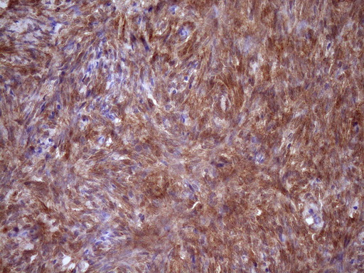 FSCN1 / Fascin Antibody - IHC of paraffin-embedded Human Ovary tissue using anti-FSCN1 mouse monoclonal antibody. (Heat-induced epitope retrieval by Tris-EDTA, pH8.0)(1:150).