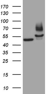 FSCN1 / Fascin Antibody - HEK293T cells were transfected with the pCMV6-ENTRY control. (Left lane) or pCMV6-ENTRY FSCN1. (Right lane) cDNA for 48 hrs and lysed. Equivalent amounts of cell lysates. (5 ug per lane) were separated by SDS-PAGE and immunoblotted with anti-FSCN1. (1:500)