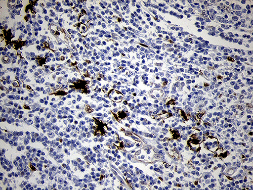 FSCN1 / Fascin Antibody - Immunohistochemical staining of paraffin-embedded Human lymph node tissue within the normal limits using anti-FSCN1 mouse monoclonal antibody. (Heat-induced epitope retrieval by 1mM EDTA in 10mM Tris buffer. (pH8.5) at 120°C for 3 min. (1:500)