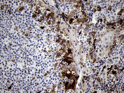 FSCN1 / Fascin Antibody - Immunohistochemical staining of paraffin-embedded Human tonsil within the normal limits using anti-FSCN1 mouse monoclonal antibody. (Heat-induced epitope retrieval by 1mM EDTA in 10mM Tris buffer. (pH8.5) at 120°C for 3 min. (1:500)